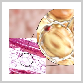 Image of fat cells under a microscope