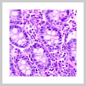 Image of cell clusters