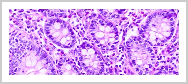 Image of cell clusters