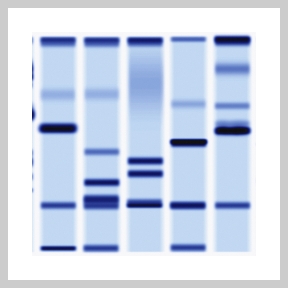 Image of DNA sequencing