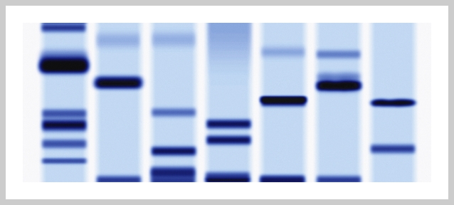 Image of DNA sequencing 